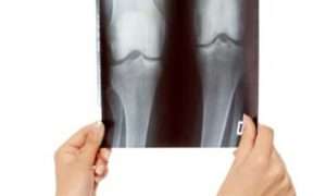 ۱۷۲۰۰۶۰۳۲_۹۳۸۳۲۵