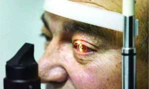 ۲۸۳۹۸۲۷_۱۱zon